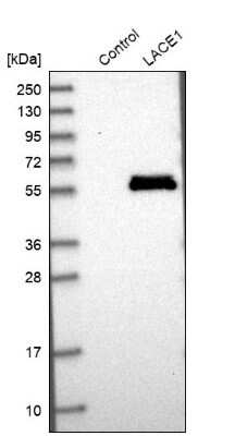 Western Blot: LACE1 Antibody [NBP1-89216] - Analysis in control (vector only transfected HEK293T lysate) and LACE1 over-expression lysate (Co-expressed with a C-terminal myc-DDK tag (3.1 kDa) in mammalian HEK293T cells).