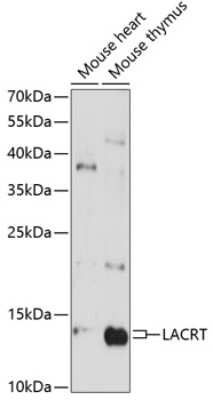 Western Blot: LACRT Antibody [NBP3-03912] - Analysis of extracts of various cell lines, using LACRT antibody at 1:3000 dilution. Secondary antibody: HRP Goat Anti-Rabbit IgG (H+L) at 1:10000 dilution. Lysates/proteins: 25ug per lane. Blocking buffer: 3% nonfat dry milk in TBST. Detection: ECL Enhanced kit.