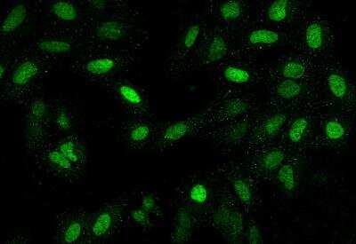 Immunocytochemistry/Immunofluorescence: LAF4 Antibody [NBP3-06186] - Staining of AFF3 in U2OS cells. Cells were fixed with 4% PFA, permeabilzed with 0.1% Triton X-100 in PBS,blocked with 10% serum, and incubated with rabbit anti-Human AFF3 polyclonal antibody (dilution ratio 1:200) at 4? overnight. Then cells were stained with the Alexa Fluor®488-conjugated Goat Anti-rabbit IgG secondary antibody (green). Positive staining was localized to Nucleus.