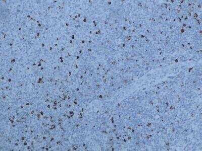 Immunohistochemistry-Paraffin: LAG-3 Antibody (17B4) [NBP1-97657] - LAG-3 in human tonsil tissue sample. Image submitted by a verified customer review.