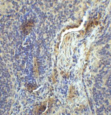 Immunohistochemistry: LAG-3 Antibody (2B11) - VHH [NBP3-12838] - Immunohistochemistry of LAG-3 in human lymph node tissue with LAG-3 single domain antibody at 1 ug/mL.