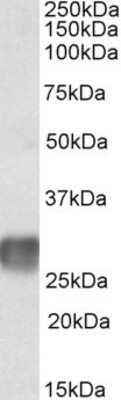 Western Blot: LAIR1 Antibody [NBP1-52010] - (2ug/ml) staining of Human Lymph Node lysate (35ug protein in RIPA buffer). Primary incubation was 1 hour. Detected by chemiluminescence.