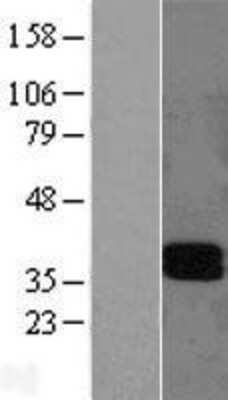 Western Blot: LAIR1 Overexpression Lysate (Adult Normal) [NBL1-12426] Left-Empty vector transfected control cell lysate (HEK293 cell lysate); Right -Over-expression Lysate for LAIR1.