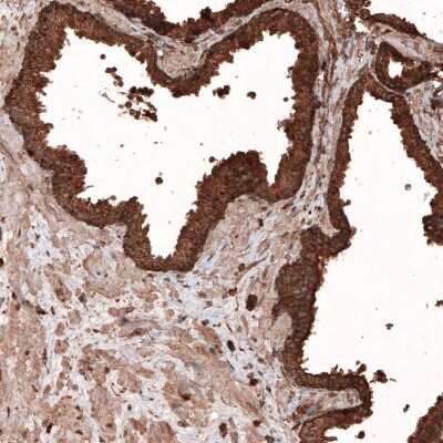 Immunohistochemistry-Paraffin: LAMP-1/CD107a Antibody (CL4463) [NBP2-59051] - Staining of human prostate shows strong granular cytoplasmic immunoreactivity in glandular cells and moderate positivity in smooth muscle.