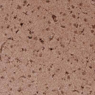 Immunohistochemistry-Paraffin: LAMP-1/CD107a Antibody (CL4463) [NBP2-59051] - Staining of human cerebral cortex shows strong cytoplasmic positivity in a subset of cells as well as moderate immunoreactivity in neuropil.