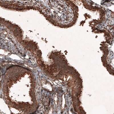 Immunohistochemistry-Paraffin: LAMP-1/CD107a Antibody (CL4463) [NBP2-59051] - Staining of human fallopian tube shows strong granular cytoplasmic immunoreactivity in glandular cells.