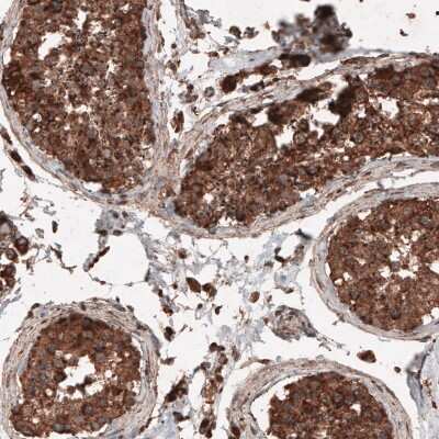 Immunohistochemistry-Paraffin: LAMP-1/CD107a Antibody (CL4463) [NBP2-59051] - Staining of human testis shows strong cytoplasmic positivity in cells in seminiferous tubules.