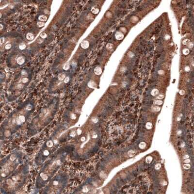 Immunohistochemistry-Paraffin: LAMP-1/CD107a Antibody (CL4463) [NBP2-59051] - Staining of human duodenum shows strong cytoplasmic immunoreactivity in glandular cells and in lymphoid cells.