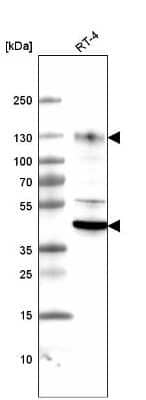 Western Blot: LAMP-1/CD107a Antibody (CL4463) [NBP2-59051] - Analysis in human cell line RT-4.