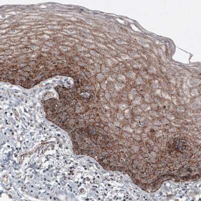 Immunohistochemistry-Paraffin: LAMP-1/CD107a Antibody (CL4489) [NBP2-59053] - Staining of human cervix shows granular cytoplasmic immunoreactivity in squamous epithelium cells.