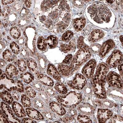 Immunohistochemistry-Paraffin: LAMP-1/CD107a Antibody (CL4489) [NBP2-59053] - Staining of human kidney shows strong granular cytoplasmic positivity in renal tubules and glomeruli.