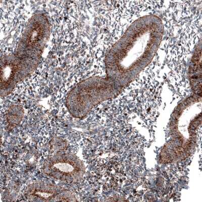 Immunohistochemistry-Paraffin: LAMP-1/CD107a Antibody (CL4489) [NBP2-59053] - Staining of human endometrium shows granular cytoplasmic positivity in glandular cells.