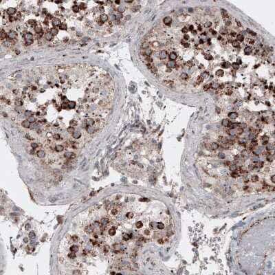 Immunohistochemistry-Paraffin: LAMP-1/CD107a Antibody (CL4489) [NBP2-59053] - Staining of human testis shows cytoplasmic positivity in cells in seminiferous tubules.