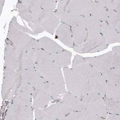 Immunohistochemistry-Paraffin: LAMP-1/CD107a Antibody (CL4489) [NBP2-59053] - Staining of human skeletal muscle shows only weak cytoplasmic positivity in muscle fibers.