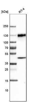 Western Blot: LAMP-1/CD107a Antibody (CL4489) [NBP2-59053] - Analysis in human cell line RT-4.