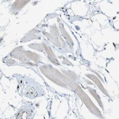 Immunohistochemistry-Paraffin: LAMP-1/CD107a Antibody [NBP1-86557] - Staining of human skeletal muscle shows low expression as expected.