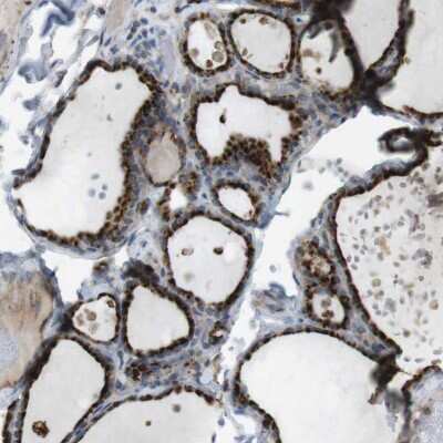 <b>Orthogonal Strategies Validation. </b>Immunohistochemistry-Paraffin: LAMP-1/CD107a Antibody [NBP1-86557] - Staining of human thyroid gland shows high expression.