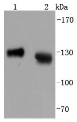 Western Blot: LAMP-1/CD107a Antibody (JJ0940) [NBP2-66927] - Analysis of LAMP1 on different lysates using anti-LAMP1 antibody at 1/1,000 dilution. Positive control: Lane 1: Hela Lane 2: Jurkat