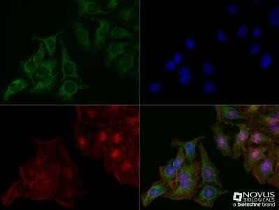 Immunocytochemistry/Immunofluorescence: LAMP-2/CD107b Antibody (H4B4) - Azide and BSA Free [NBP2-80825] - HeLa cells were fixed for 10 minutes using 10% formalin and then permeabilized for 5 minutes using 1X TBS + 0.5% Triton X-100. The cells were incubated with anti-LAMP-2/CD107b [NBP2-22217] at a 1:100 dilution overnight at 4C and detected with an anti-mouse Dylight 488 (Green) at a 1:500 dilution. Actin was detected with Phalloidin 568 (Red) at a 1:200 dilution. Nuclei were counterstained with DAPI (Blue). Cells were imaged using a 40X objective. Image from the standard format of this antibody.