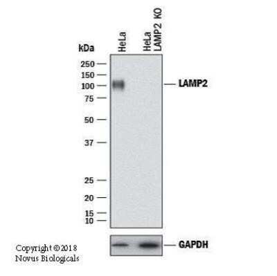 Western Blot: LAMP-2/CD107b Antibody (H4B4) - Azide and BSA Free [NBP2-80825] - Lysates of HeLa human cervical epithelial carcinoma parental cell line and LAMP2 knockout (KO) HeLa cell line. PVDF membrane was probed with Mouse Anti-Human LAMP-2/CD107b (H4B4) Monoclonal Antibody (Catalog # NBP2-22217) followed by HRP-conjugated Anti-Rabbit IgG Secondary Antibody (Catalog #HAF008). Specific band was detected for LAMP-2/CD107b at approximately 100 kDa (as indicated) in the parental HeLa cell line, but is not detectable in the knockout HeLa cell line. This experiment was conducted under reducing conditions. Image from the standard format of this antibody.