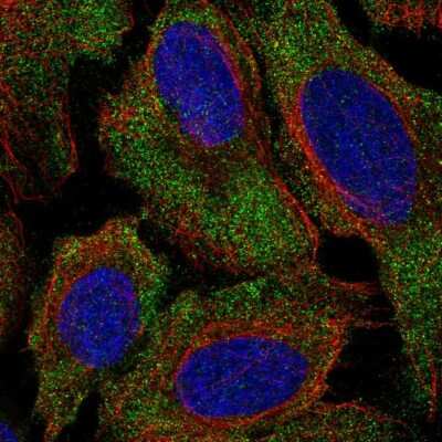 Immunocytochemistry/Immunofluorescence: LAMP Antibody [NBP2-58253] - Staining of human cell line U-2 OS shows localization to cytosol.