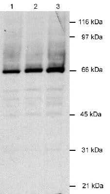 Western Blot: LANA2 Antibody (CM-A807) [NB200-167] - Detection of LANA2 in infected lysates (30 ug) using 2 ug/ml of NB 200-167. ECL detection 1.5 minutes. Lane 1: BCBL-1 (KSHV+) Lane 2: BC-1 (KSHV+/EBV+) Lane 3: BCP-1 (KSHV+)