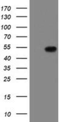 Western Blot: LANCL2 Antibody (OTI2A11) - Azide and BSA Free [NBP2-72053] - HEK293T cells were transfected with the pCMV6-ENTRY control (Left lane) or pCMV6-ENTRY LANCL2 (Right lane) cDNA for 48 hrs and lysed. Equivalent amounts of cell lysates (5 ug per lane) were separated by SDS-PAGE and immunoblotted with anti-LANCL2.