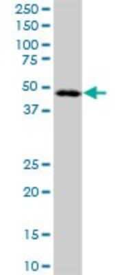 Western Blot: LANCL2 Antibody [H00055915-B01P] - Analysis of LANCL2 expression in A-431.