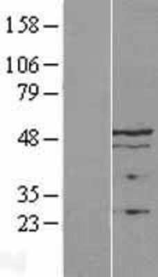 Western Blot: LAP2 Overexpression Lysate (Adult Normal) [NBL1-17119] Left-Empty vector transfected control cell lysate (HEK293 cell lysate); Right -Over-expression Lysate for LAP2.