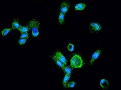 Immunocytochemistry/Immunofluorescence: LAP3 Antibody [NBP2-97066] - Immunofluorescence staining of LAP3 in A431 cells. Cells were fixed with 4% PFA, permeabilzed with 0.3% Triton X-100 in PBS, blocked with 10% serum, and incubated with rabbit anti-human LAP3 polyclonal antibody (1:1000) at 4C overnight. Then cells were stained with the Alexa Fluor(R)488-conjugated Goat Anti-rabbit IgG secondary antibody (green) and counterstained with DAPI (blue). Positive staining was localized to cytoplasm and nucleus.