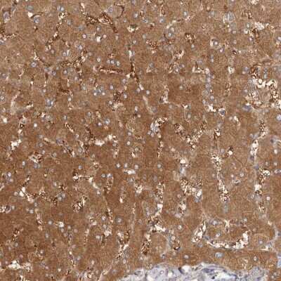 Immunohistochemistry-Paraffin: LAP3 Antibody [NBP1-82847] - Staining of human liver shows strong cytoplasmic positivity in hepatocytes.