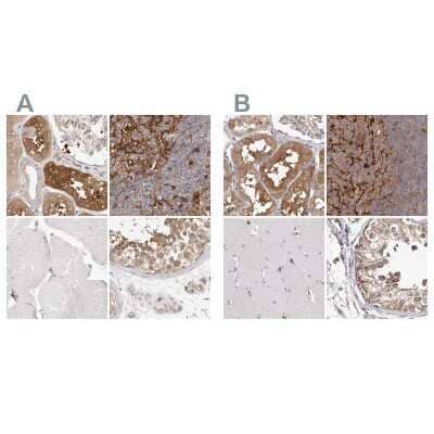 <b>Independent Antibodies Validation. </b>Immunohistochemistry-Paraffin: LAP3 Antibody [NBP1-82847] - Staining of human kidney, lymph node, skeletal muscle and testis using Anti-LAP3 antibody NBP1-82847 (A) shows similar protein distribution across tissues to independent antibody NBP1-82848 (B).