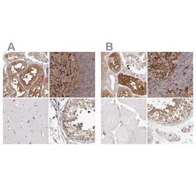 <b>Independent Antibodies Validation. </b>Immunohistochemistry-Paraffin: LAP3 Antibody [NBP1-82848] - Staining of human kidney, lymph node, skeletal muscle and testis using Anti-LAP3 antibody NBP1-82848 (A) shows similar protein distribution across tissues to independent antibody NBP1-82847 (B).