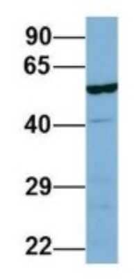 Western Blot: LAP3 Antibody [NBP1-53152] - Human 721_B, Antibody Dilution: 1.0 ug/ml LAP3 is supported by BioGPS gene expression data to be expressed in 721_B.