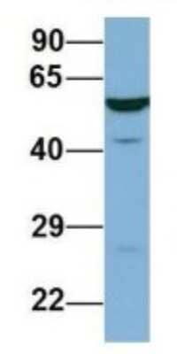 Western Blot: LAP3 Antibody [NBP1-53152] - Human Fetal Lung, Antibody Dilution: 1.0 ug/ml.