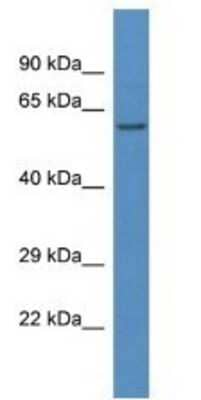 Western Blot: LAP3 Antibody [NBP1-79642] - Mouse Liver Lysate 1ug/ml  Gel Concentration 12%