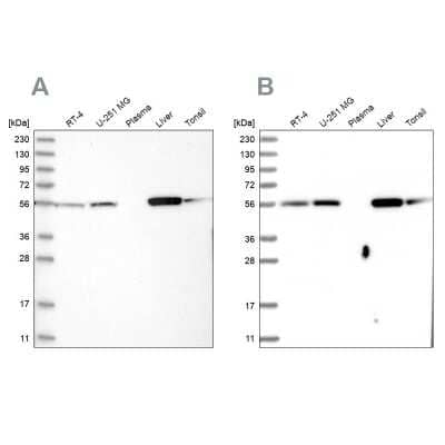 Western Blot: LAP3 Antibody [NBP1-82848] - Analysis using Anti-LAP3 antibody NBP1-82848 (A) shows similar pattern to independent antibody NBP1-82847 (B).