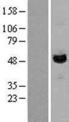 Western Blot: LAP3 Overexpression Lysate (Adult Normal) [NBL1-12435] Left-Empty vector transfected control cell lysate (HEK293 cell lysate); Right -Over-expression Lysate for LAP3.