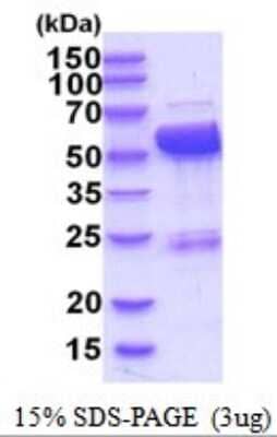 SDS-Page: LAP3 Recombinant Protein [NBP2-52032] - 15% SDS Page (3 ug)