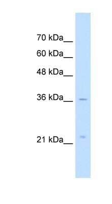 Western Blot: LAPTM4A Antibody [NBP1-59964] - HepG2 cell lysate, concentration 5.0ug/ml.