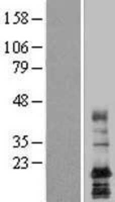 Western Blot: LAPTM4A Overexpression Lysate (Adult Normal) [NBL1-12436] Left-Empty vector transfected control cell lysate (HEK293 cell lysate); Right -Over-expression Lysate for LAPTM4A.