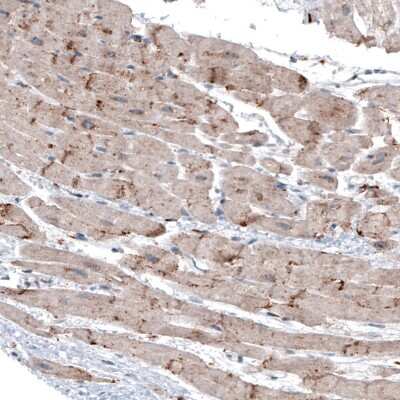 Immunohistochemistry LAPTM4B Antibody (CL5289) - BSA Free