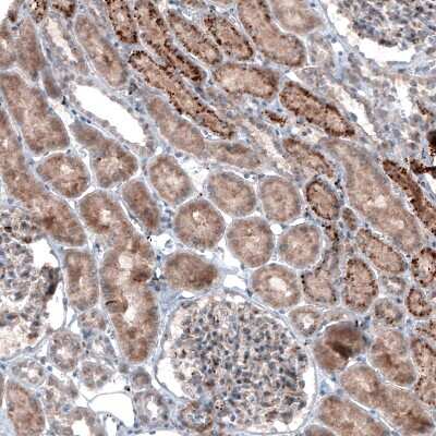 Immunohistochemistry LAPTM4B Antibody (CL5289) - BSA Free