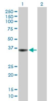 Western Blot: LAR/PTPRF Antibody [H00005792-B01P] - Analysis of PTPRF expression in transfected 293T cell line by PTPRF polyclonal antibody.  Lane 1: PTPRF transfected lysate(38.83 KDa). Lane 2: Non-transfected lysate.