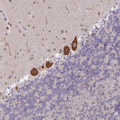 Immunohistochemistry: LARP1 Antibody [NBP2-49151] - Staining of human cerebellum shows strong cytoplasmic positivity in Purkinje cells.