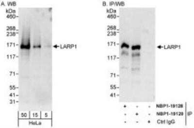 Western Blot: LARP1 Antibody [NBP1-19129] - Whole cell lysate (5, 15 and 50 mcg for WB; 1 mg for IP, 20% of IP loaded) from HeLa cells.  Affinity purified rabbit anti-LARP1 used for WB at 0.04 mcg/ml (A) and 1 mcg/ml (B) and used for IP at 3 mcg/mg lysate.  LARP1 was also immunoprecipitated by rabbit anti-LARP1 antibody NBP1-19128, which recognizes an upstream epitope.