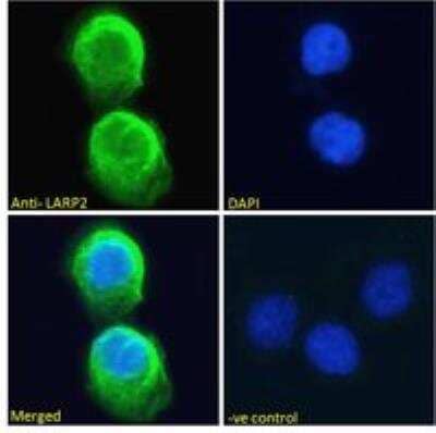 Immunocytochemistry/Immunofluorescence: LARP2 Antibody [NB100-60945] - Analysis of paraformaldehyde fixed A431 cells, permeabilized with 0.15% Triton. Primary incubation 1hr (10 ug/mL) followed by Alexa Fluor 488 secondary antibody (2 ug/mL), showing cytoplasmic staining. The nuclear stain is DAPI (blue). Negative control: Unimmunized goat IgG (10 ug/mL) followed by Alexa Fluor 488 secondary antibody (2 ug/mL).