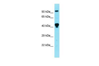 Western Blot: LARP5 Antibody [NBP3-10540] - Western blot analysis of LARP5 in Mouse Thymus lysates. Antibody dilution at 1.0ug/ml