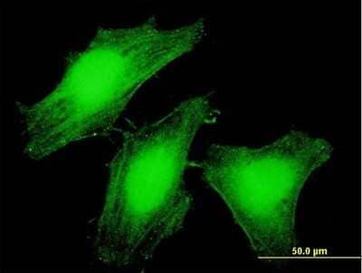 Immunocytochemistry/Immunofluorescence: LARP6 Antibody [H00055323-B01P] - Analysis of purified antibody to LARP6 on HeLa cell. (antibody concentration 10 ug/ml)