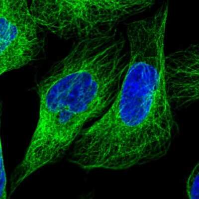 Immunocytochemistry/Immunofluorescence: LARP6 Antibody [NBP2-55021] - Staining of human cell line U-2 OS shows localization to microtubules & cytokinetic bridge. Antibody staining is shown in green. 